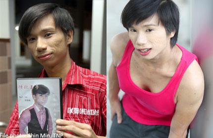 Meet Kurt, The Singapore Man With Boobs